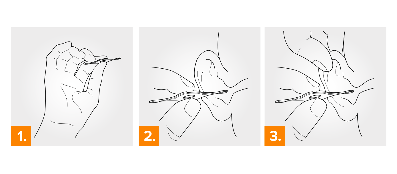 rappresentazione grafica di come usare curetta auricolare Cerumenclip